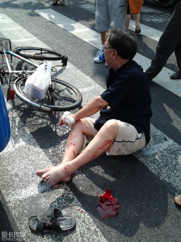 公交车自行车刚发生一起流血事件,轮子从脚面