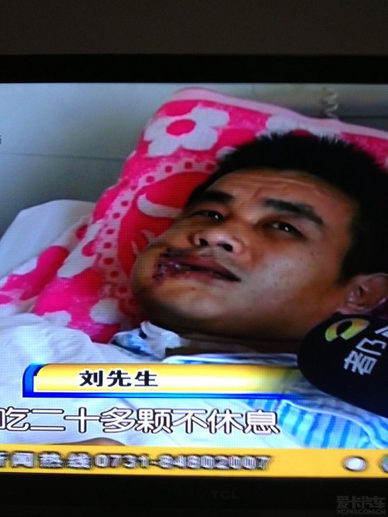 大家少吃槟榔吧