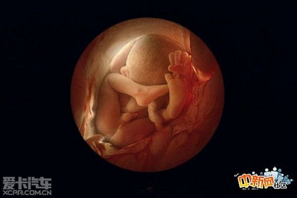 36周的胎宝宝图片图片