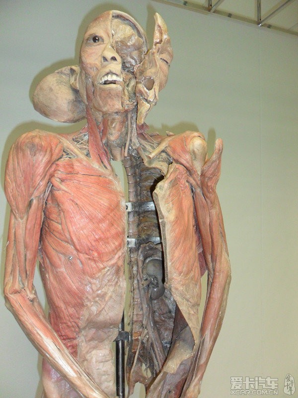 法医解剖过程实拍人体图片
