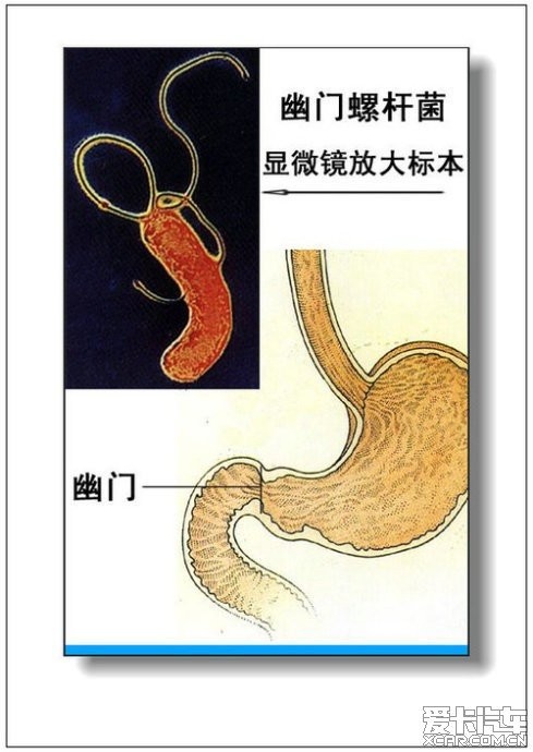 男人,女人體器官及病理(彩圖詳解)(68/77)