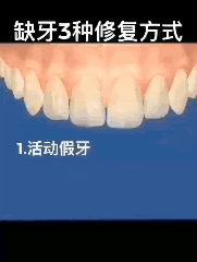 你牙有缺失吗
