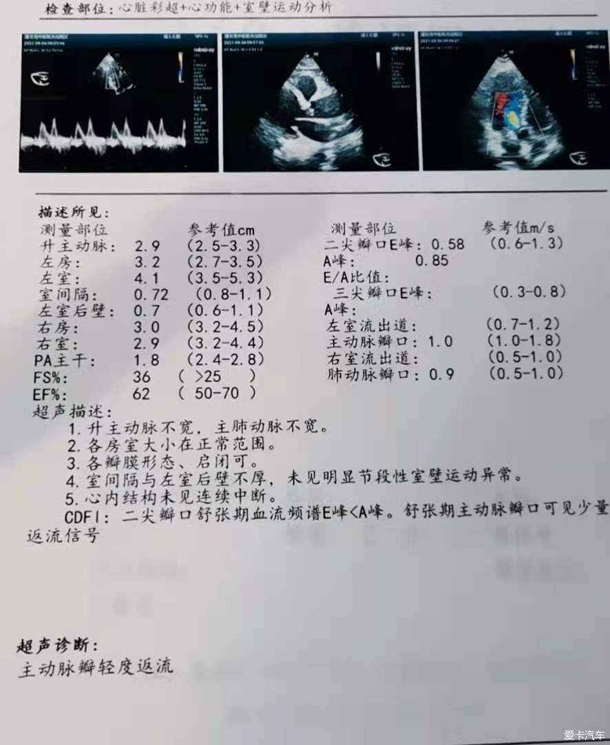 有人看看心脏彩超吗?(1/1)