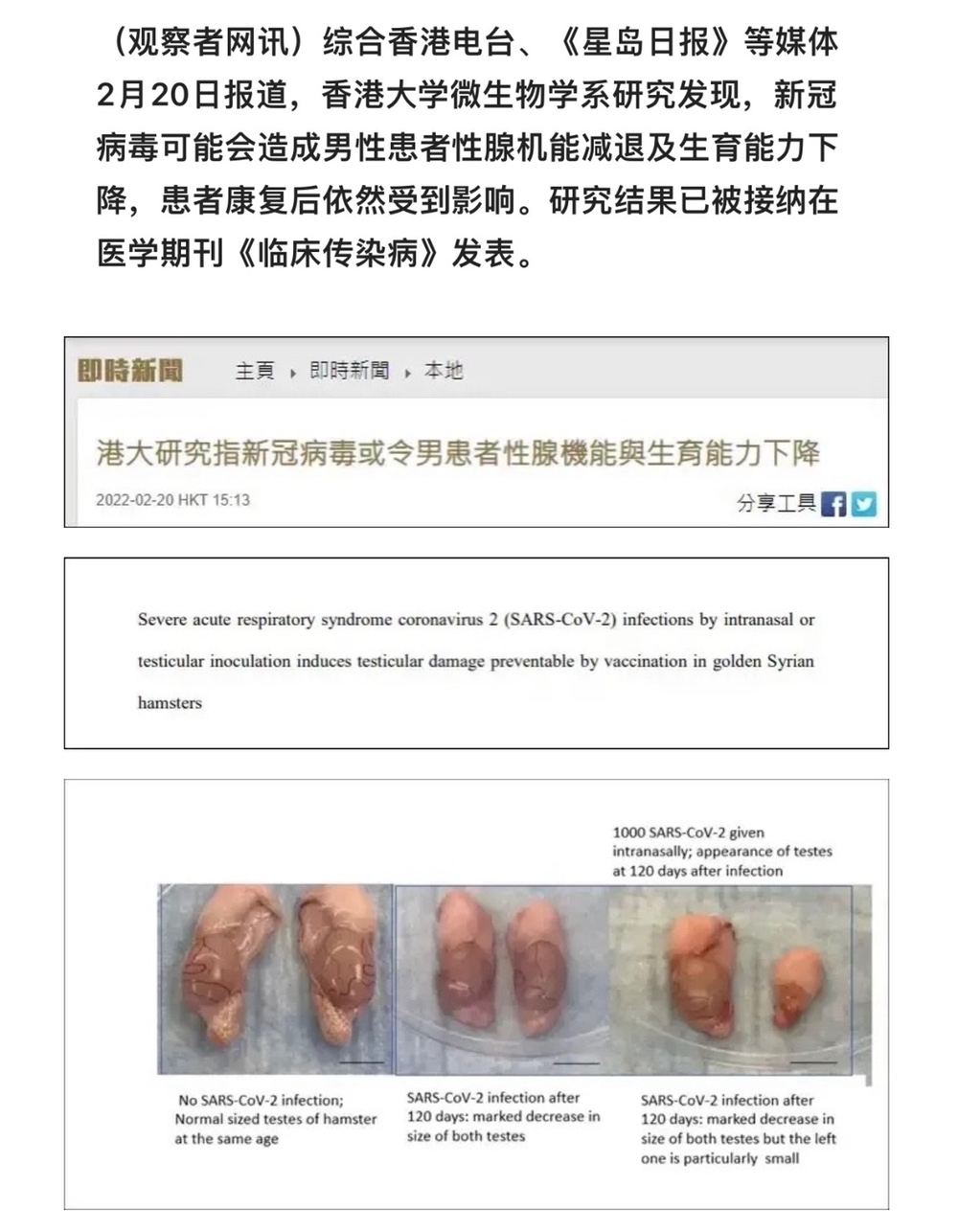 香港大学研究感染新冠120天后睾丸萎缩的快没了